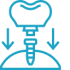 dental-implant